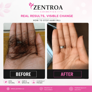 How to Stop Hair Fall eBook how to stop hair fall ebook